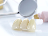 Несъемное протезирование