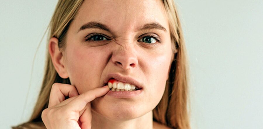 Проблемы с деснами, как вылечить?