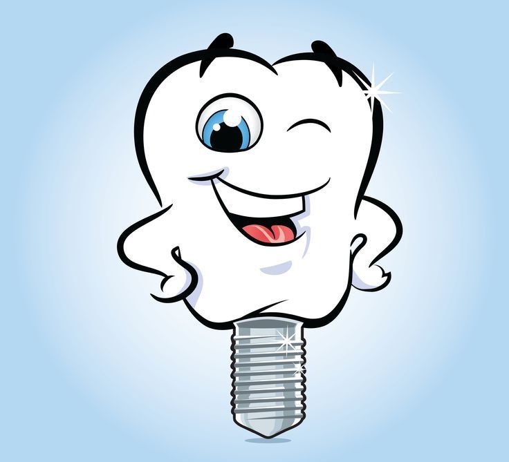 Какую имплантацию зубов выбрать: сразу после удаления или классическую?