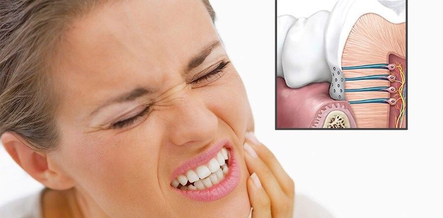 Как избавиться от зубной боли