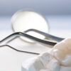 Имплантация зубов: Как выбрать оптимальное решение для вашего случая