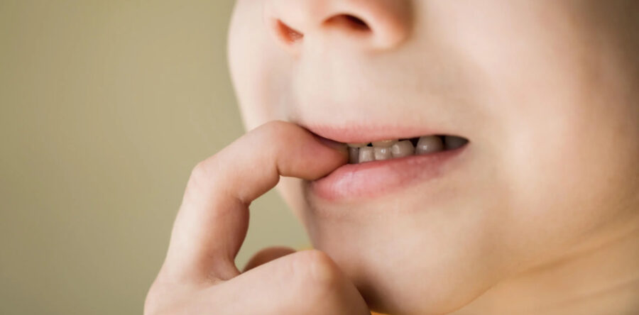 Можно ли сохранить молочный зуб, если он шатается?